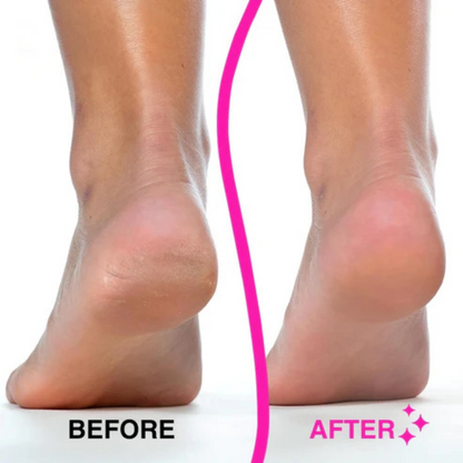 The LeStrova PureSole Pro