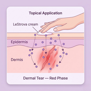 Apply During the Red Phase