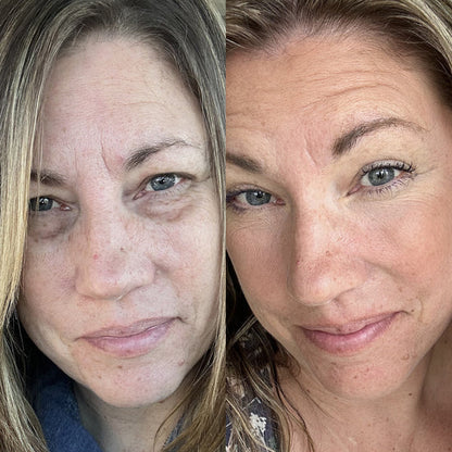 The LeStrova Radiance Lift