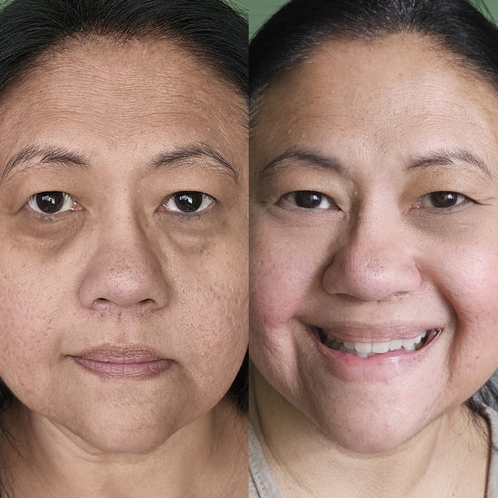 The LeStrova Radiance Lift