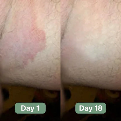 Lestrova Antifungal Soap
