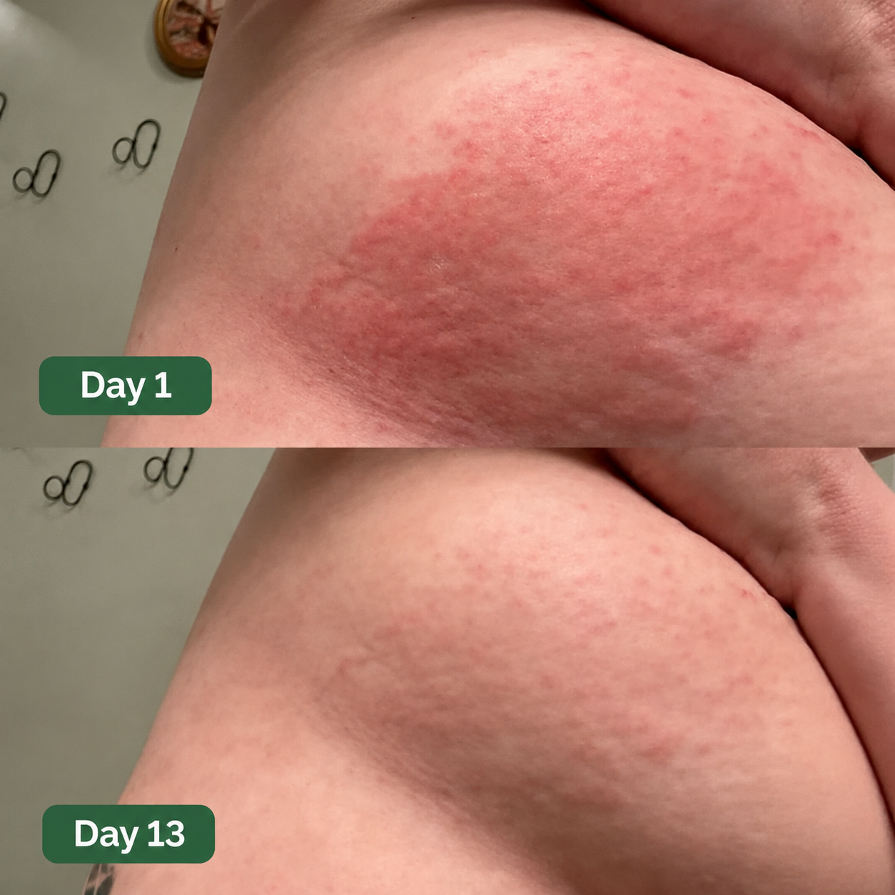 Lestrova Antifungal Boob Itch Soap