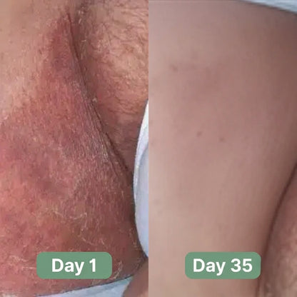 Lestrova Antifungal Soap